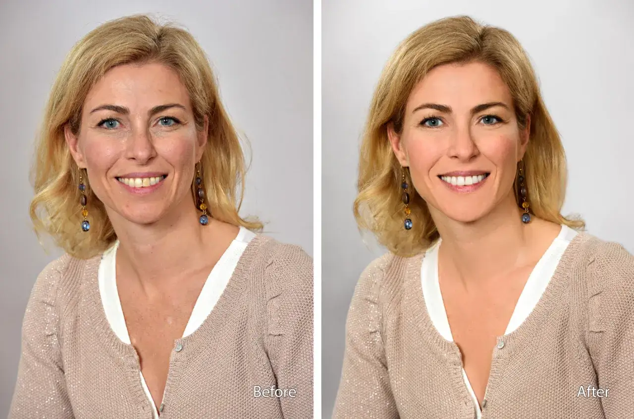 Avant/Apr&egrave;s : une femme souriante, mise en valeur par une retouche photo professionnelle qui illumine son visage et lisse sa peau.